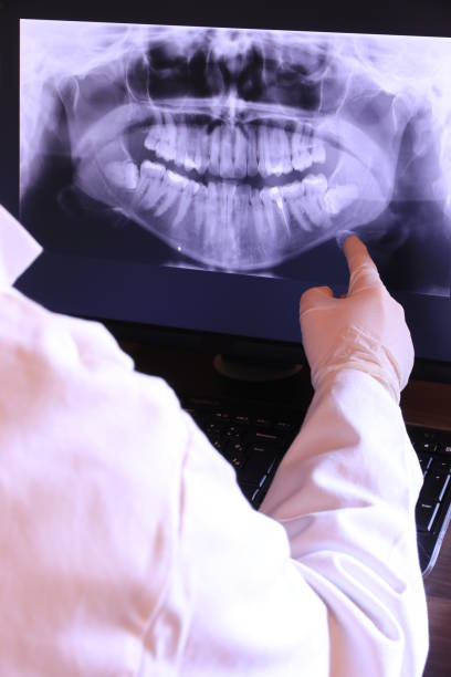 Best Emergency Care for Gum Disease in Montezuma, IA