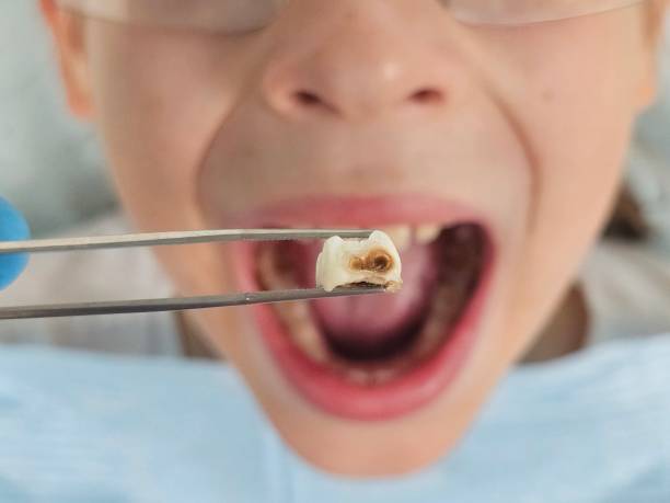 Best Emergency Treatment for Jaw Pain or Injury in Montezuma, IA